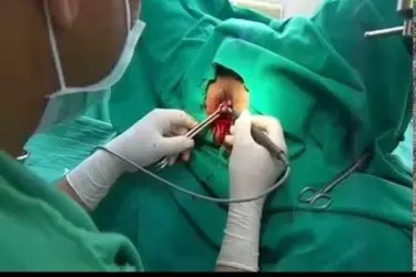 best hospital for piles surgery in Narsinghpur, best doctor for piles fissure treatment in Narsinghpur, cost of piles fissure surgery in Narsinghpur